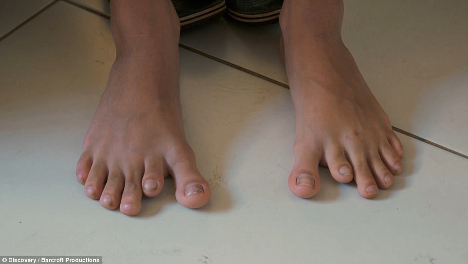 454114AE00000578-4973342-On_the_feet_the_addition_toe_is_located_between_the_big_toe_and_-a-8_1507829493719.jpg