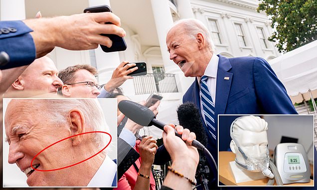 Biden, 80, is now using a CPAP machine to treat sleep apnea