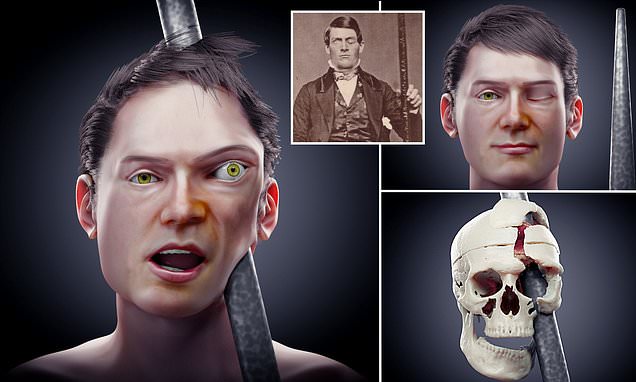 Meet the man who was shot in the head with an iron rod - and SURVIVED: Scientists