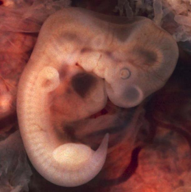 Human-embryos-have-tails.jpg